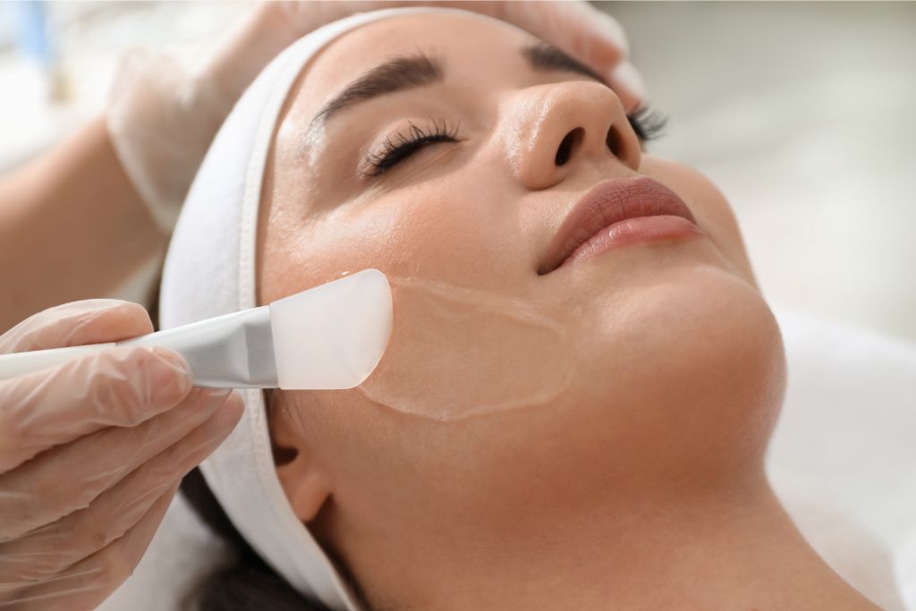 Peeling chimique : guide complet pour un teint éclatant et sans imperfections